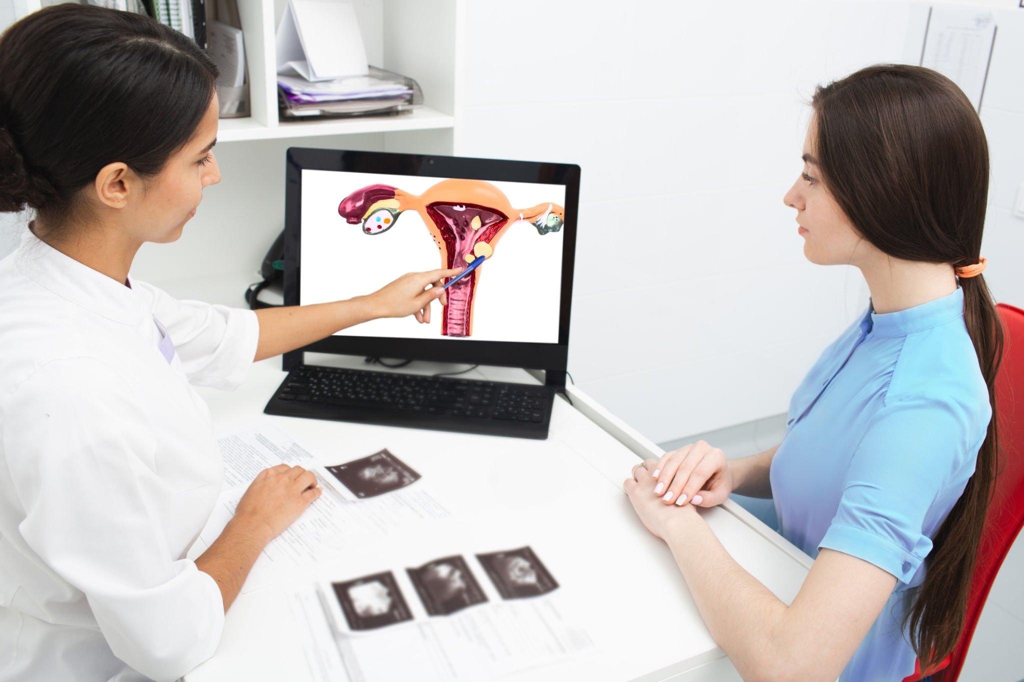 How to Treat Fibroid Cysts Holistically: A Step-by-Step Guide